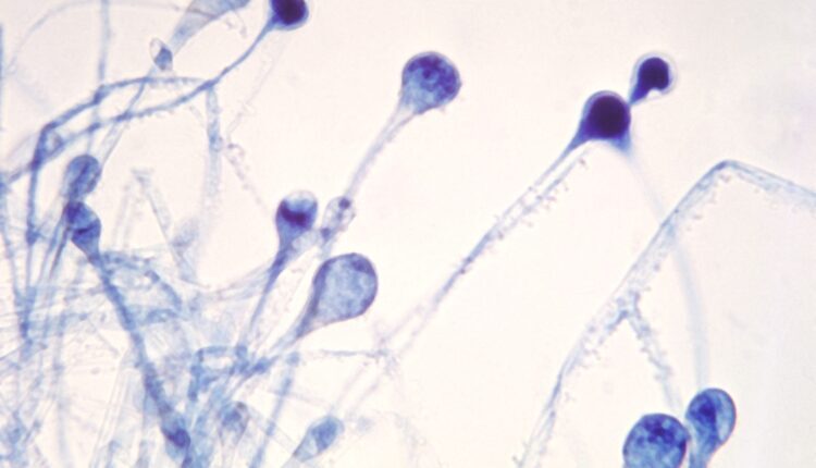 الفطر الأسود