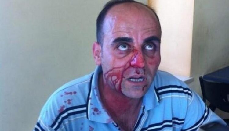 على طريقة ورواية اغتيال خاشقجي.. السلطة الفلسطينية تقتل الناشط والمعارض نزار بنات