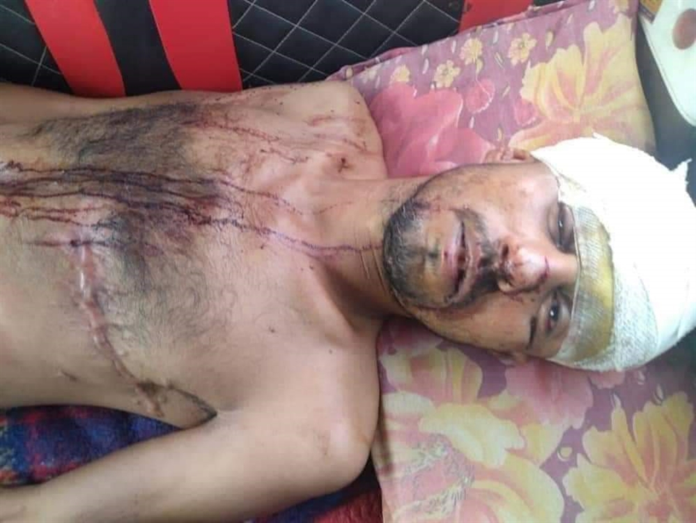 عمليات خطف وتعذيب شديد متبادل بين مليشيا الإمارات في اليمن