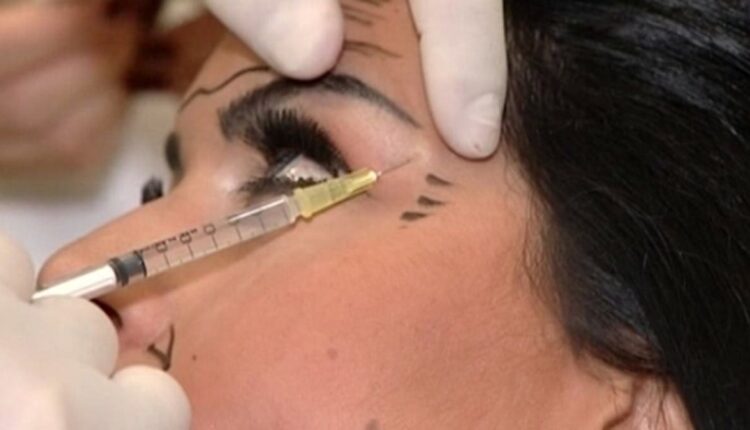 السعودية.. أغرب عمليات التجميل