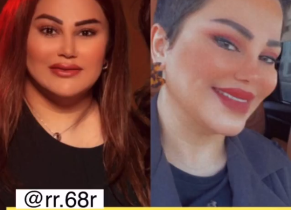 سبب التغير الصادم في مظهر فاطمة الطباخ