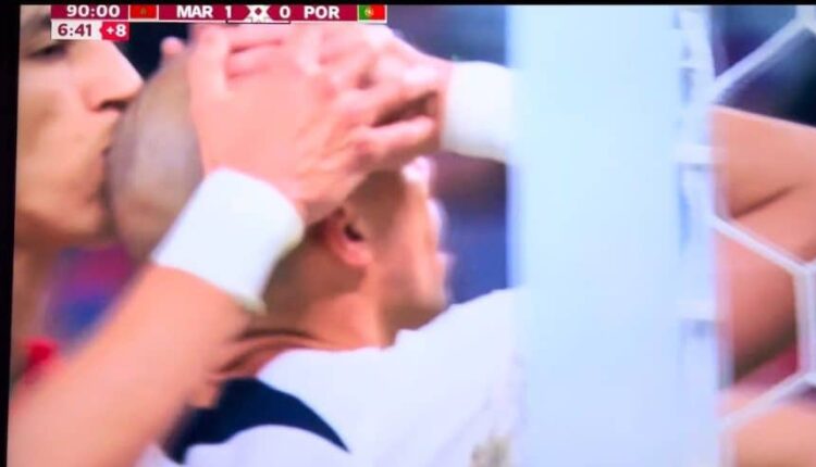 قصة القبلة على رأس الخصم