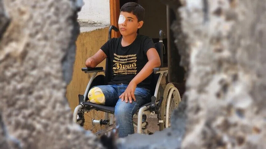 المرصد الأورومتوسطي: 10 آلاف طفل فقدوا ساقا و9 قتلى من كل 10 مدنيون في غزة